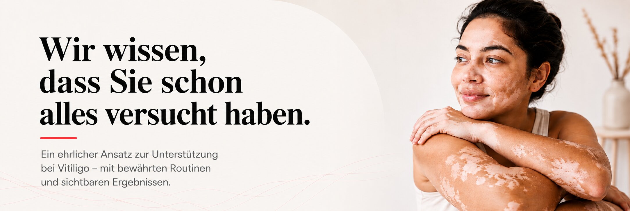 Vitiligo Behandlung Germany
