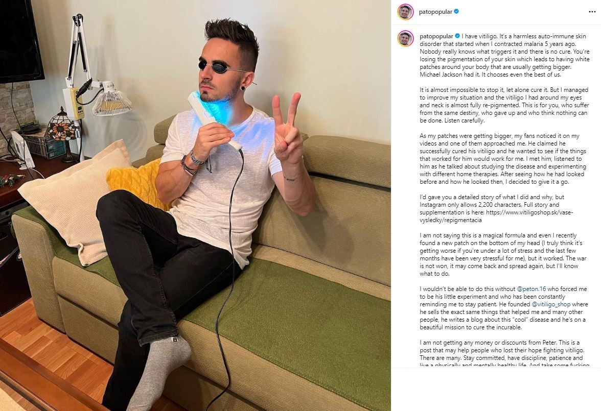 PPPeter Vitiligo Behandlung Instagram