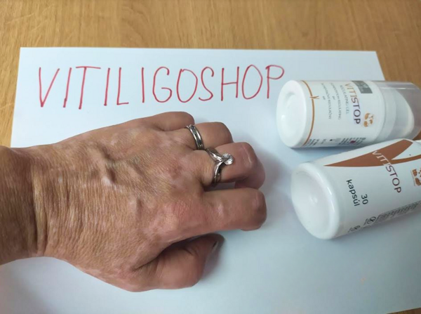 Vitistop Gel und Tabletten