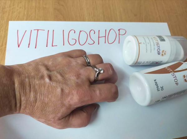 Vitistop gel und tabletten